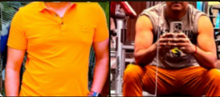 Sonny before and after